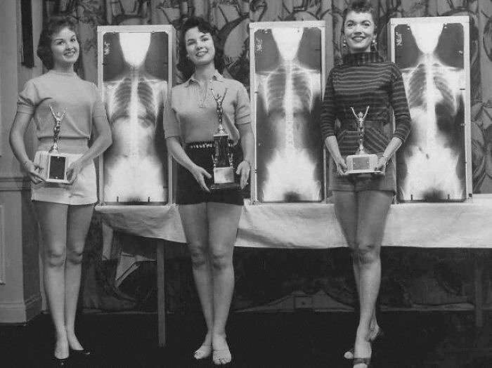 Miss Correct Posture At The 1956 Chiropractic Convention
