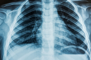 X-Rays That Took Doctors by Surprise