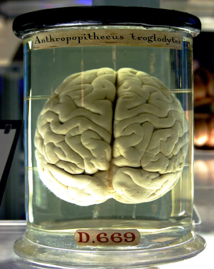 You'll Be Disturbed to Hear What Happens When You Grab a Brain