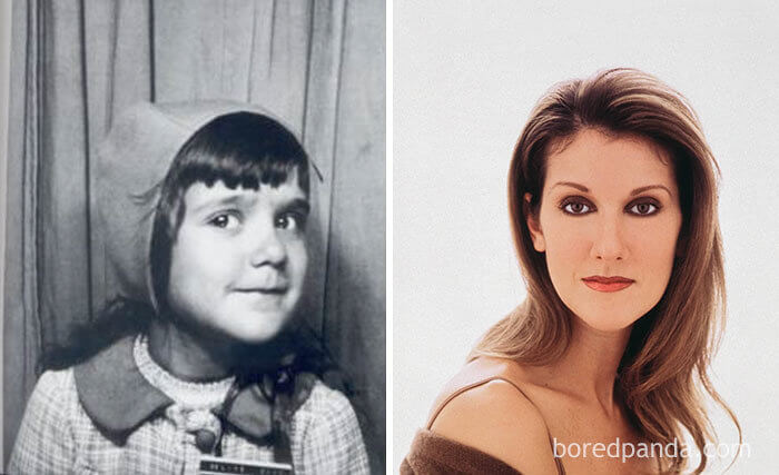 Canadian Songstress Celine Dion Does Not Need Hats Anymore