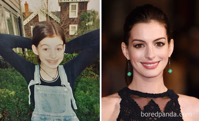 Anne Hathaway Just Clowning About As A Young Girl
