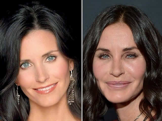 Courtney Cox – Unknown - Had All Her Fillers Removed and Now Believes "less Is More"