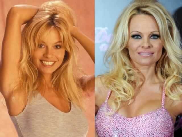 Pamela Anderson – $10,500: Hollywood Pressured Her to Stay Young