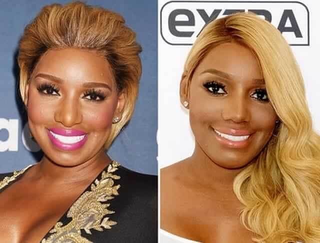 NeNe Leakes – $20,500: Advocates for "tuning Up" "problem Areas"