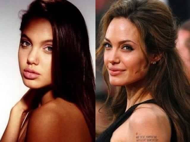 Angelina Jolie – Unknown: Had a Double Mastectomy