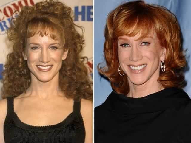 Kathy Griffin – $30,000: Hilariously Quipped She Gets Work Done Because She's Vain