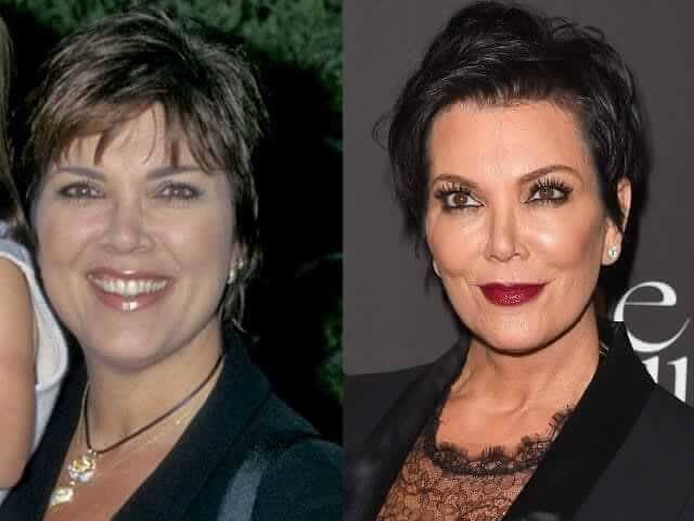 Kris Jenner – $71,000 Plus a Recent $100,000 "refresh"