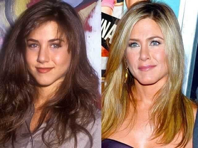 Jennifer Aniston – $30,500: The Friends Star Who Swears by a Surprising "Salmon Sperm" Facial