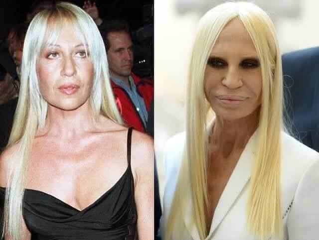 Donatella Versace – $25,000: "I'm Not a Fan of the Natural Look"