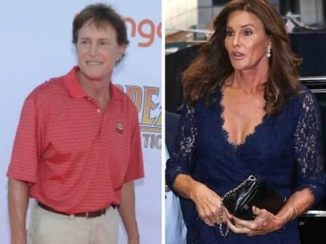 Caitlyn Jenner – $60,000: A 10-Hour Face Surgery