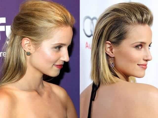 Diana Agron – $15,000 - Had 2 Rhinoplasties for Medical Reasons