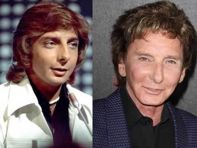 Barry Manilow – $70,000 - Had Facial Reconfiguration After a 2003 Accident