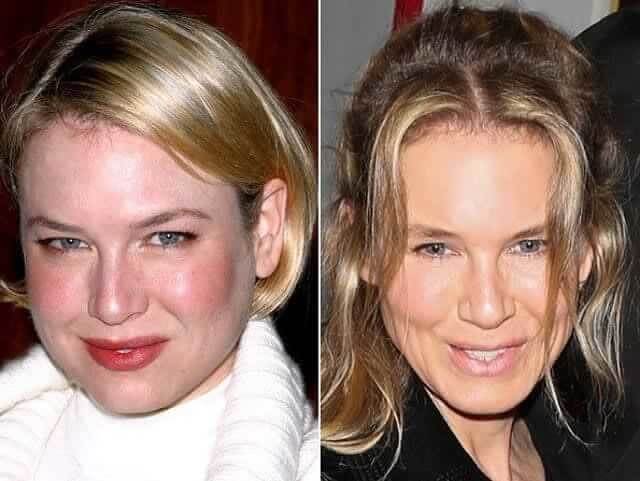 Renee Zellweger – Unknown - The Real-Life Bridget Jones