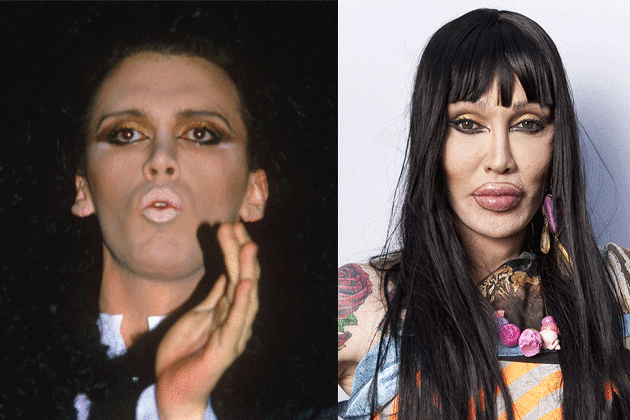 Pete Burns – $38,000: Has Had Over 300 Operations