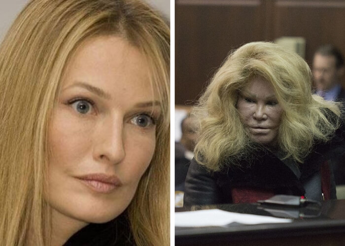 Jocelyn Wildenstein – $6.500,000: Wants to Look Like a Cat
