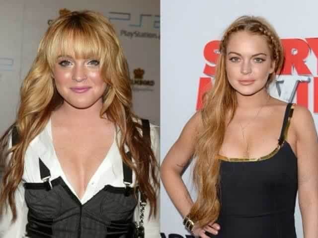 Lindsay Lohan – Unknown: Credits Her "glow-Up" to Lasers, a Strict Wellness Routine, and Carrot Juice