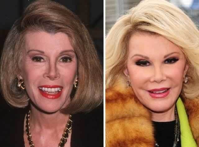Joan Rivers – $99,000: A Legacy of Unapologetic Self-Invention