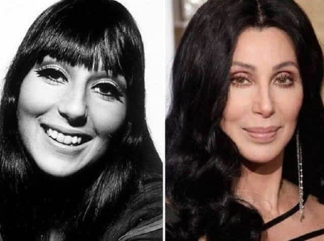 Cher – $750,000: "Yes, I’ve Had a Facelift, but Who Hasn’t? "