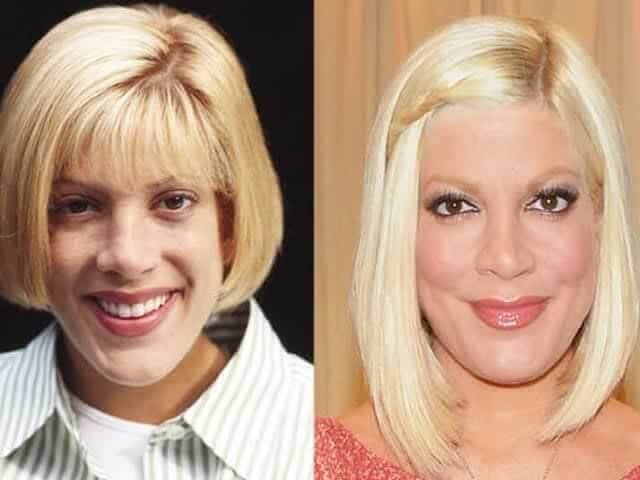 Tori Spelling – $13,000: Struggled With Breastfeeding Due to Her Procedures