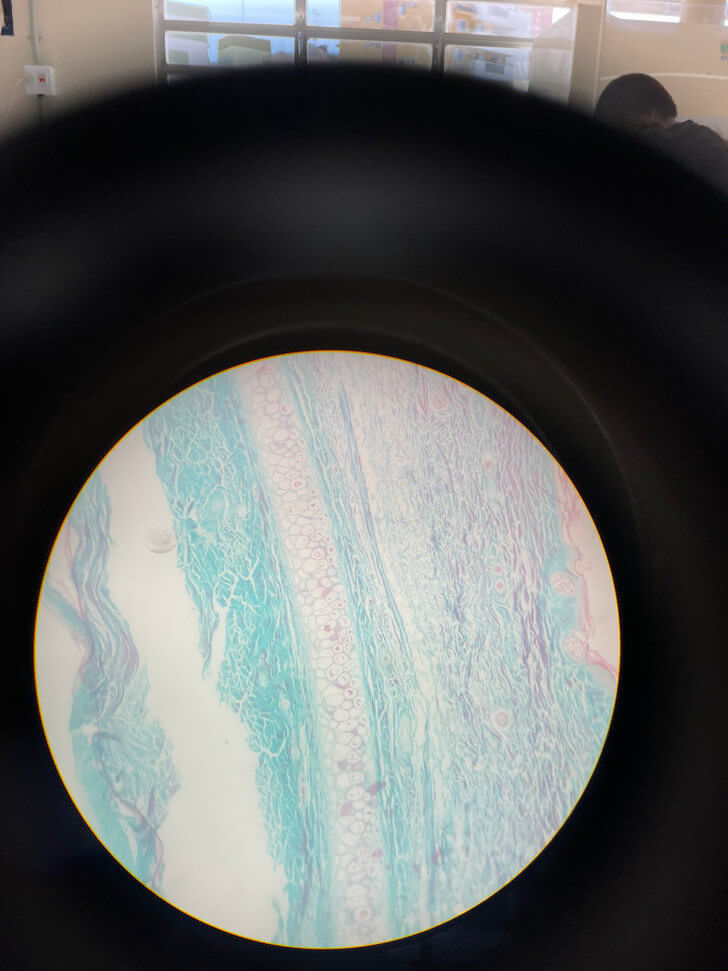 There's an Entire Planet Hidden in This Pig Ear