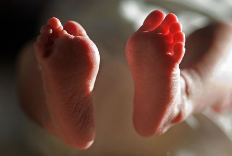 Something Unusual About The Babies