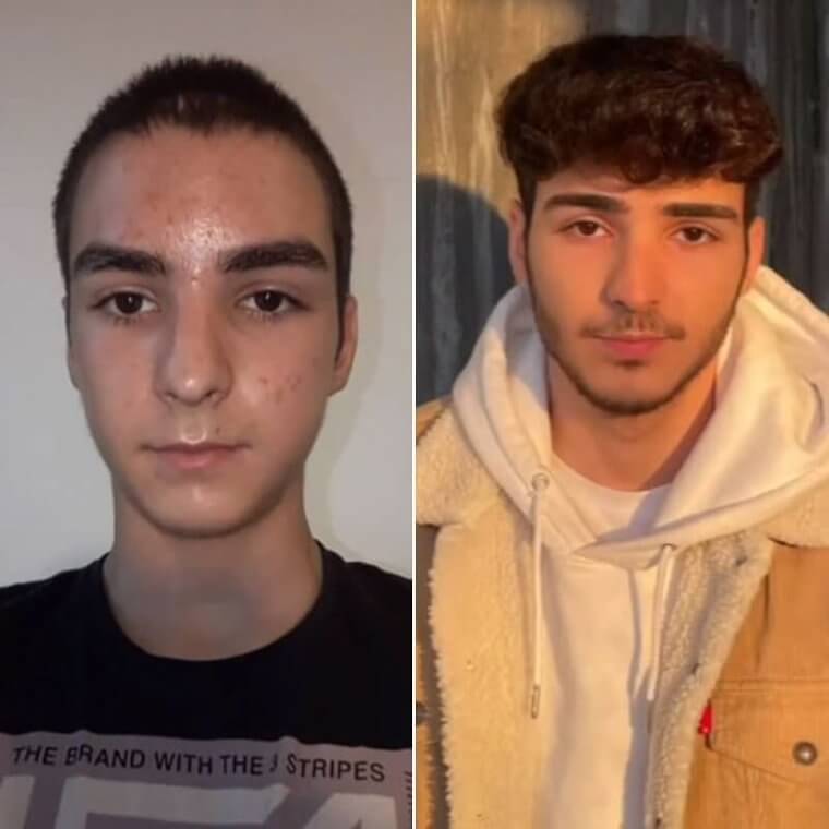 Just Wait Out Those Awkward Teen Years