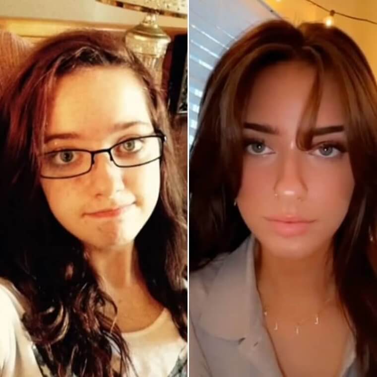 Before And After