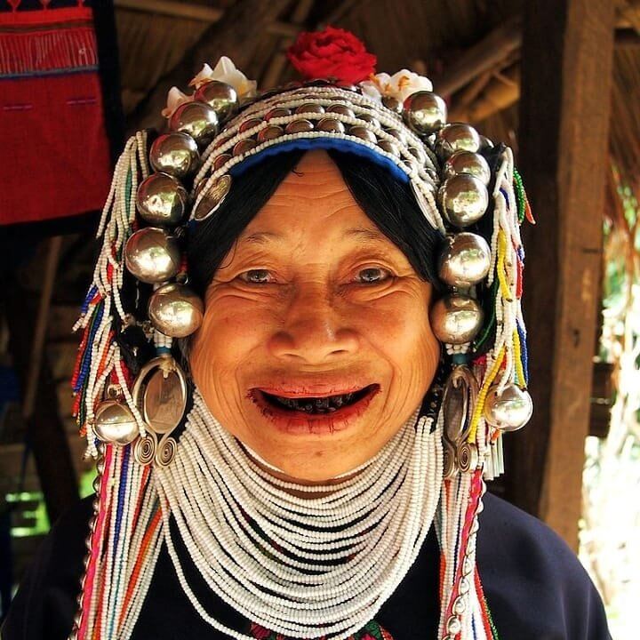 Dying Teeth Black Was Seen as Beautiful