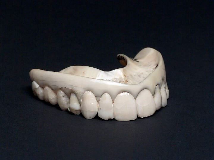 Soldiers Teeth Were Used to Make Dentures