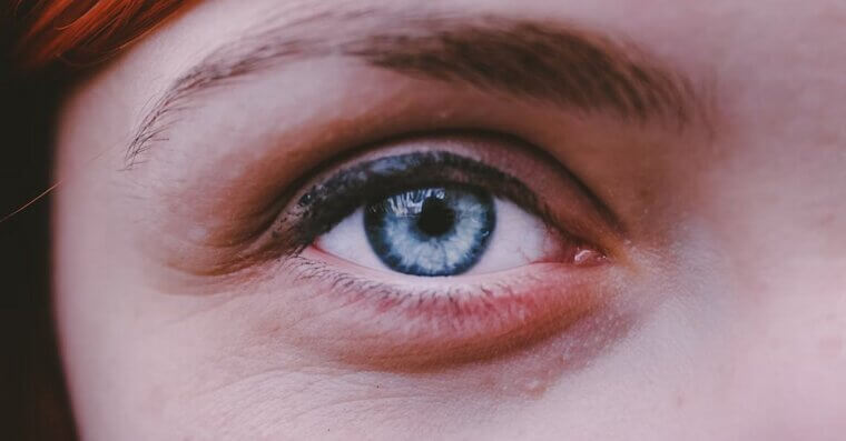 Blue-Eyed People Have a Higher Risk of Macular Degeneration