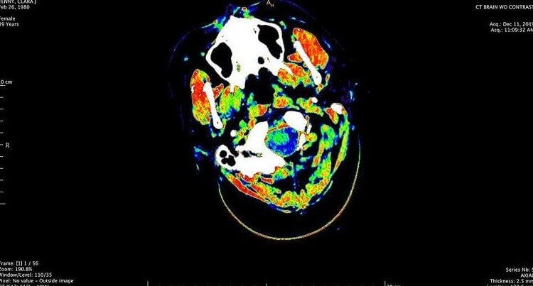 Tu n'utilises que 10 % de ton cerveau