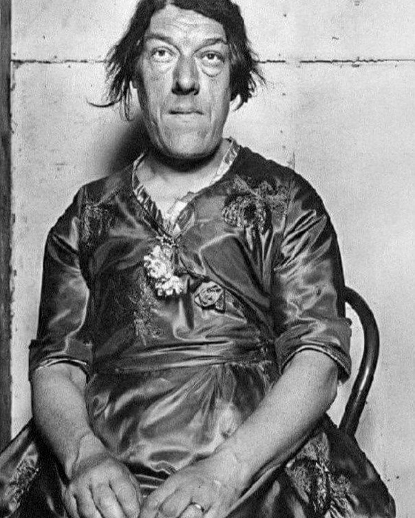 Mary Ann Bevan Was the Winner of the Ugliest Woman Contest