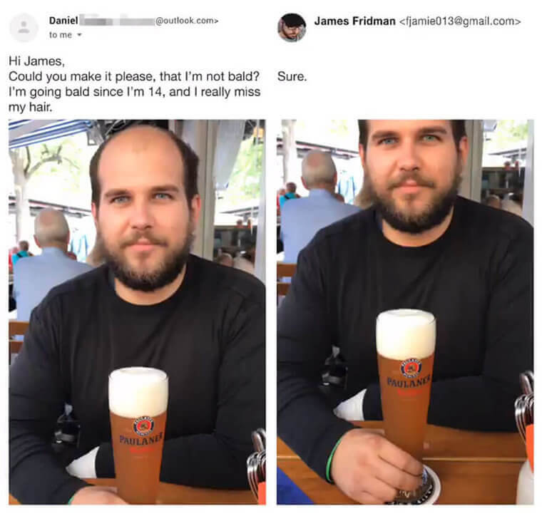 The Simple Solution to Balding