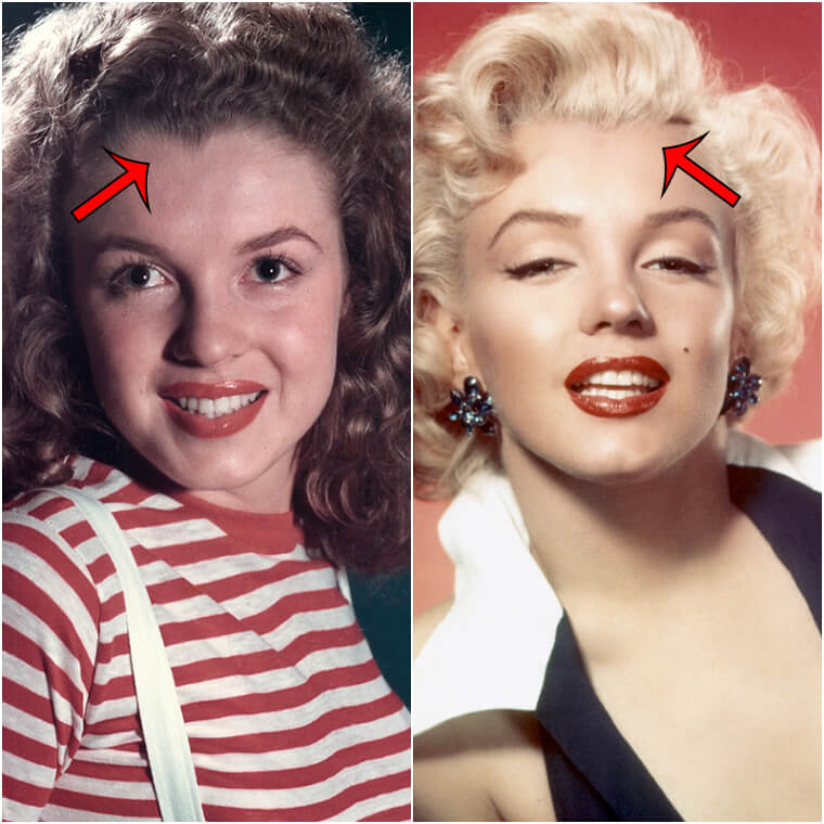 Marilyn Monroe e Rita Hayworth foram submetidas a uma eletrólise capilar super dolorosa