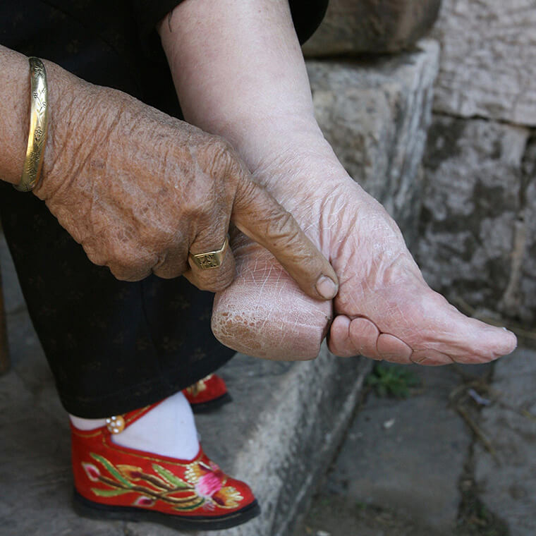 Garotas chinesas quebravam e distorciam os pés para que ficassem parecidos com uma lua crescente