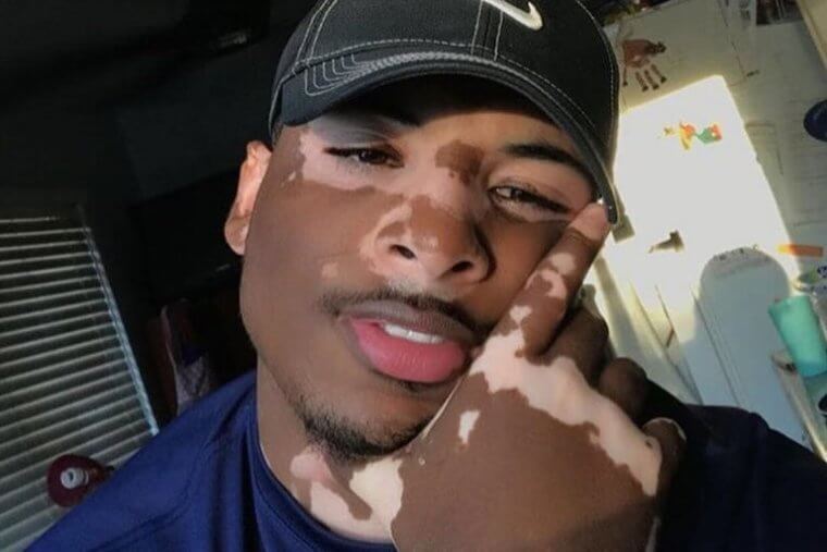 This Is a Lot More Common That We'd Think