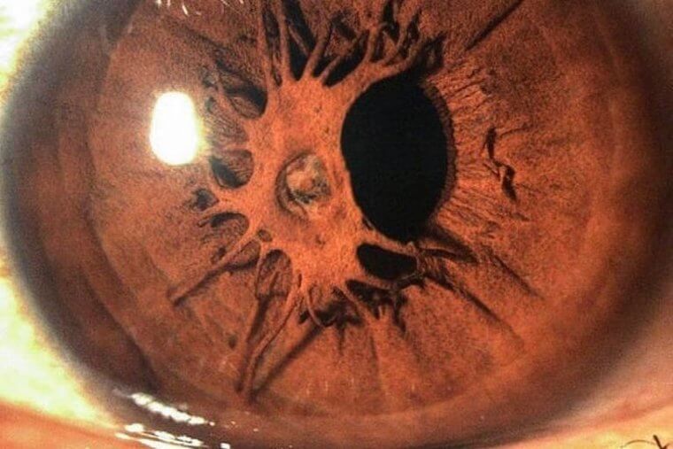 You've Got Something in Your Eye, There