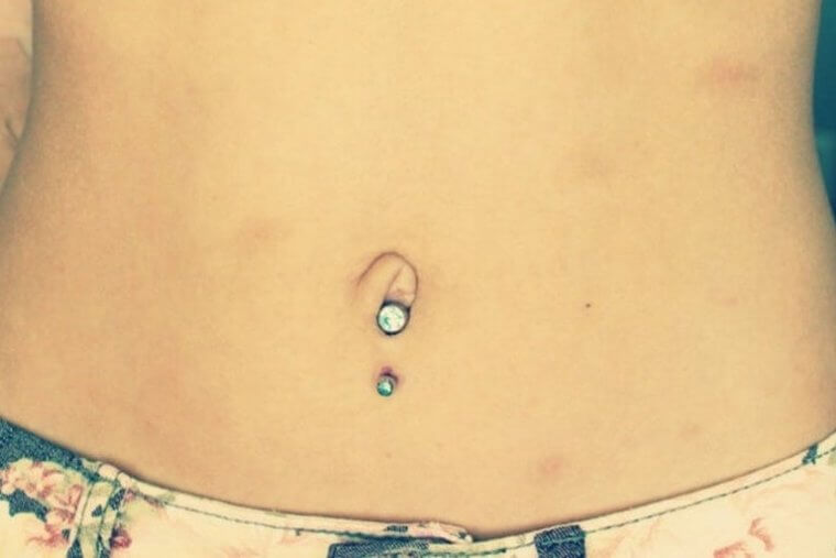 Outie Navels Rejoice