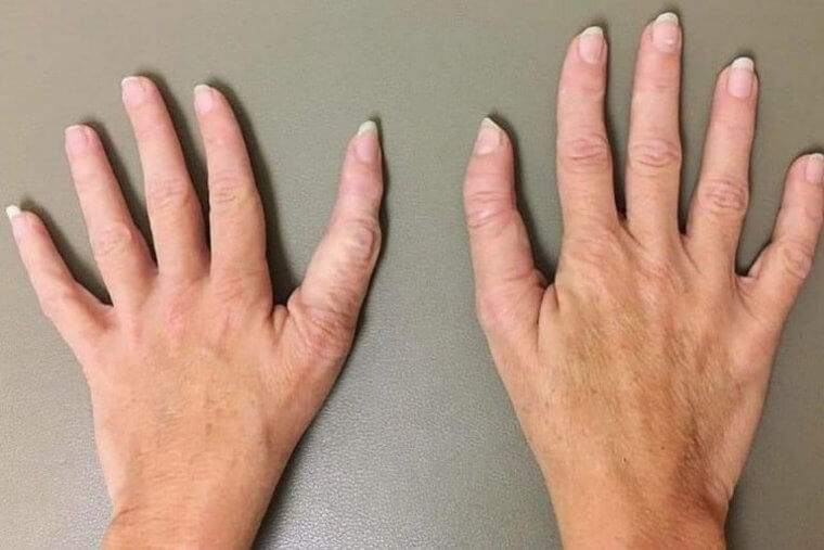These Thumbs Look Different