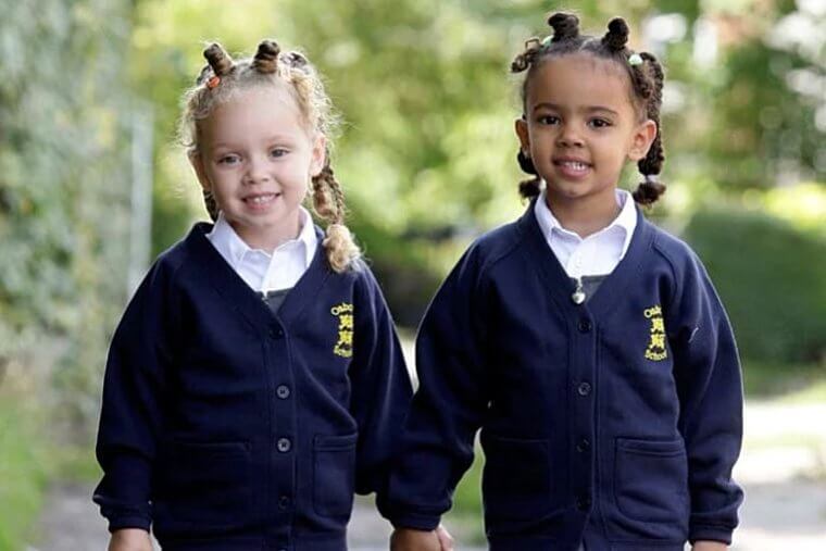 Believe It or Not, These Two Are Twins