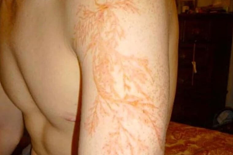 This Is Not a Tattoo