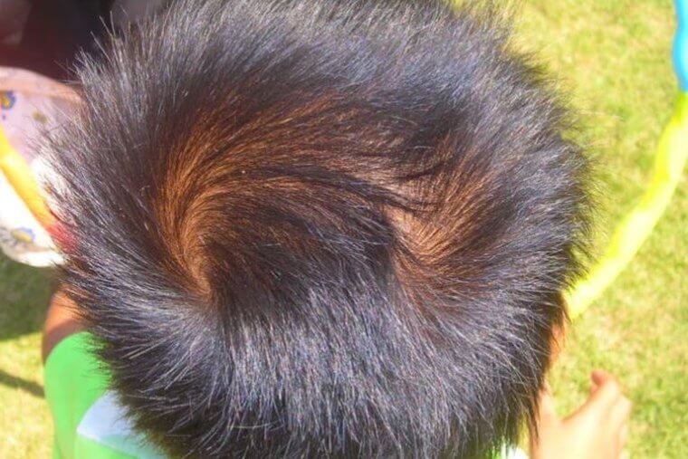 Two for the Price of One