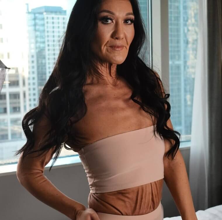 Sara Geurts and Her Remarkable Skin Condition