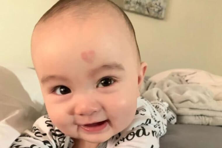 The Literal Meaning of “Love on the Brain”