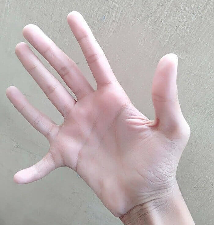 This Guy Has Six Fingers