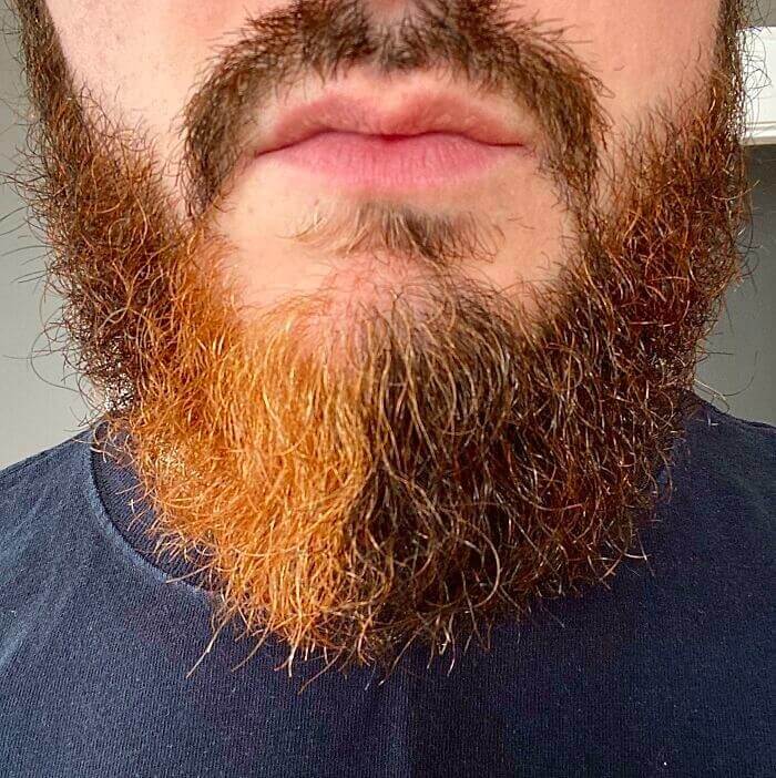 This Guy With A Half Orange And Half Brown Beard