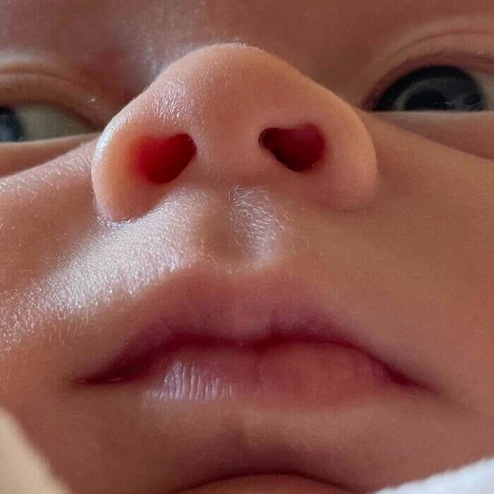 This Baby's Nostrils Look Like Tiny Hearts