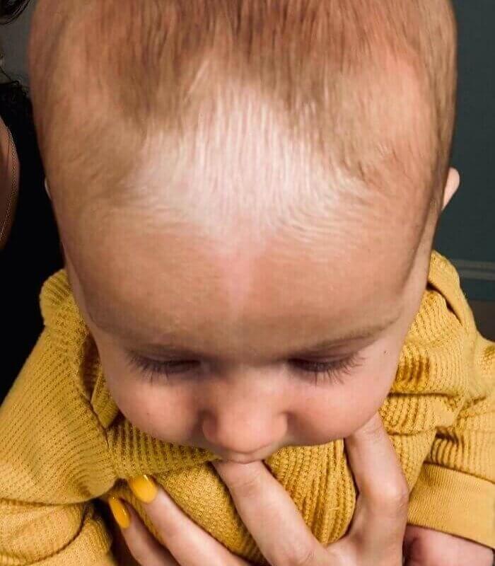 Este Bebê Nasceu Com Uma Marca De Nascimento Parecida Com Uma Seta