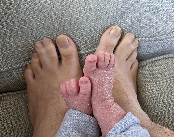 This Baby Inherited Their Dad's Joint Toes