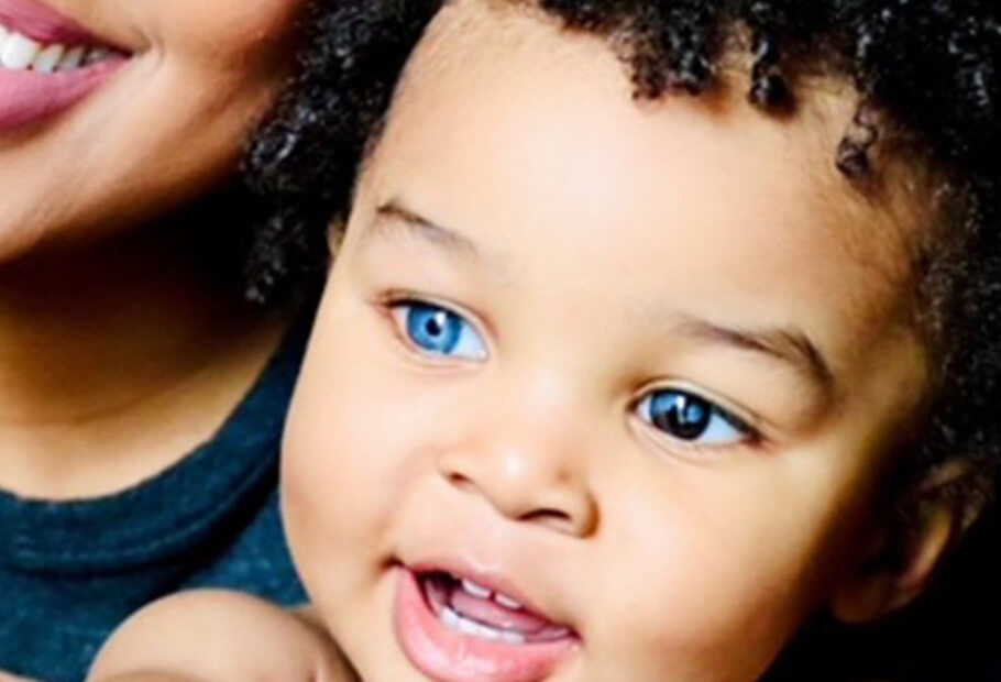 Le Condizioni Genetiche Di Queste Persone Le Rendono Davvero Uniche